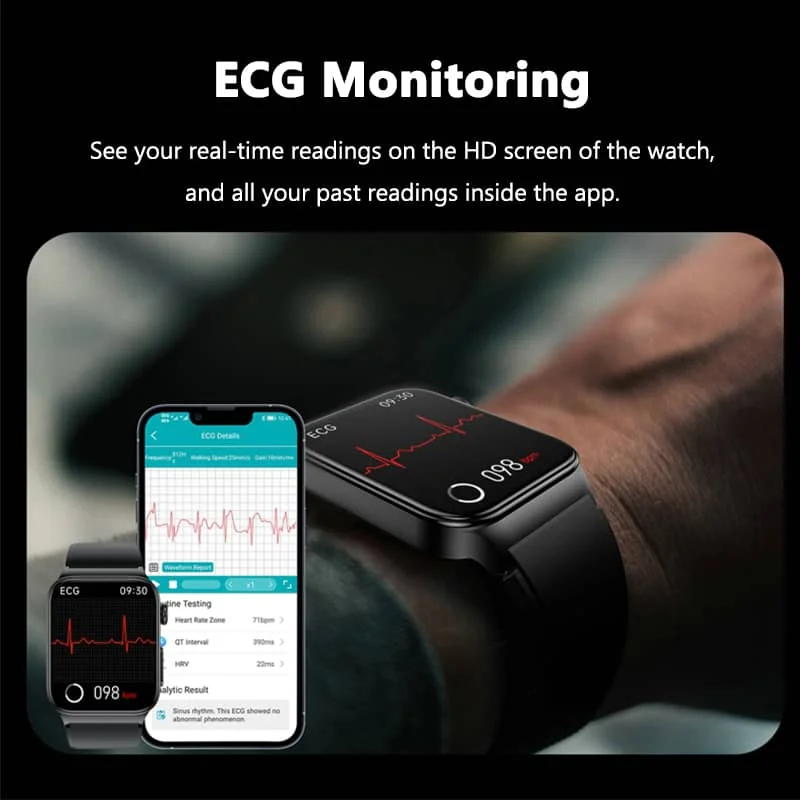 All-in-one Smartwatch voor Gezondheidsmonitoring met Ecg en Bloedglucosetracker